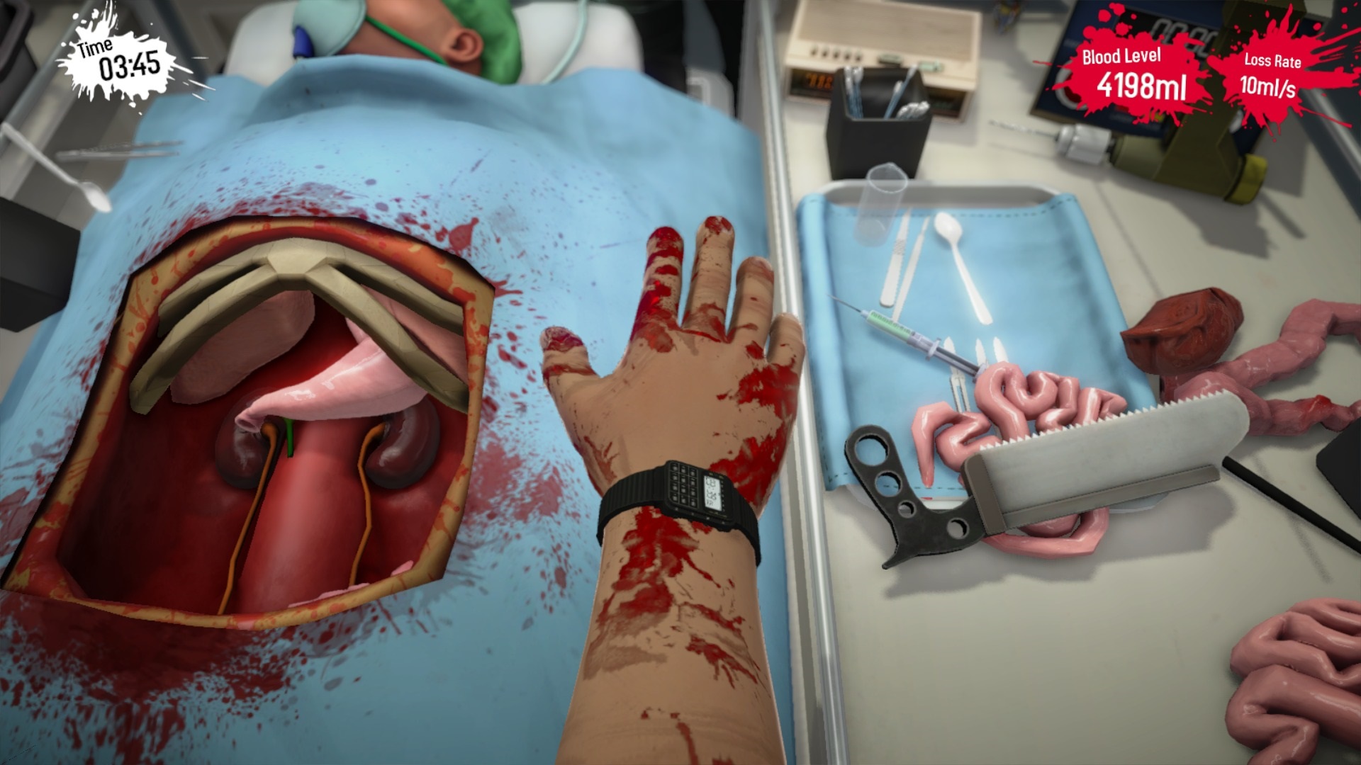Surgeon Simulator: Anniversary Edition  O poriadok v telovch dutinch pacientov sa stara nemuste.