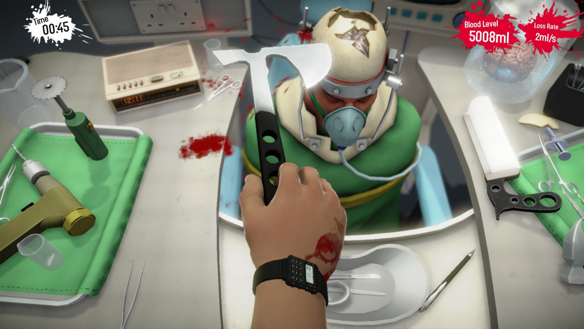 Surgeon Simulator: Anniversary Edition  Obas medzi chirurgom a drevorubaom nie je vek rozdiel.