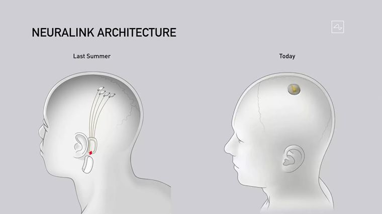 Elon Musk predstavil nov neuralink ip