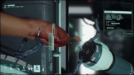 MALPRAXIS z v�s sprav� chirurgick� pr�stroj v pr�behu vo vesm�re  