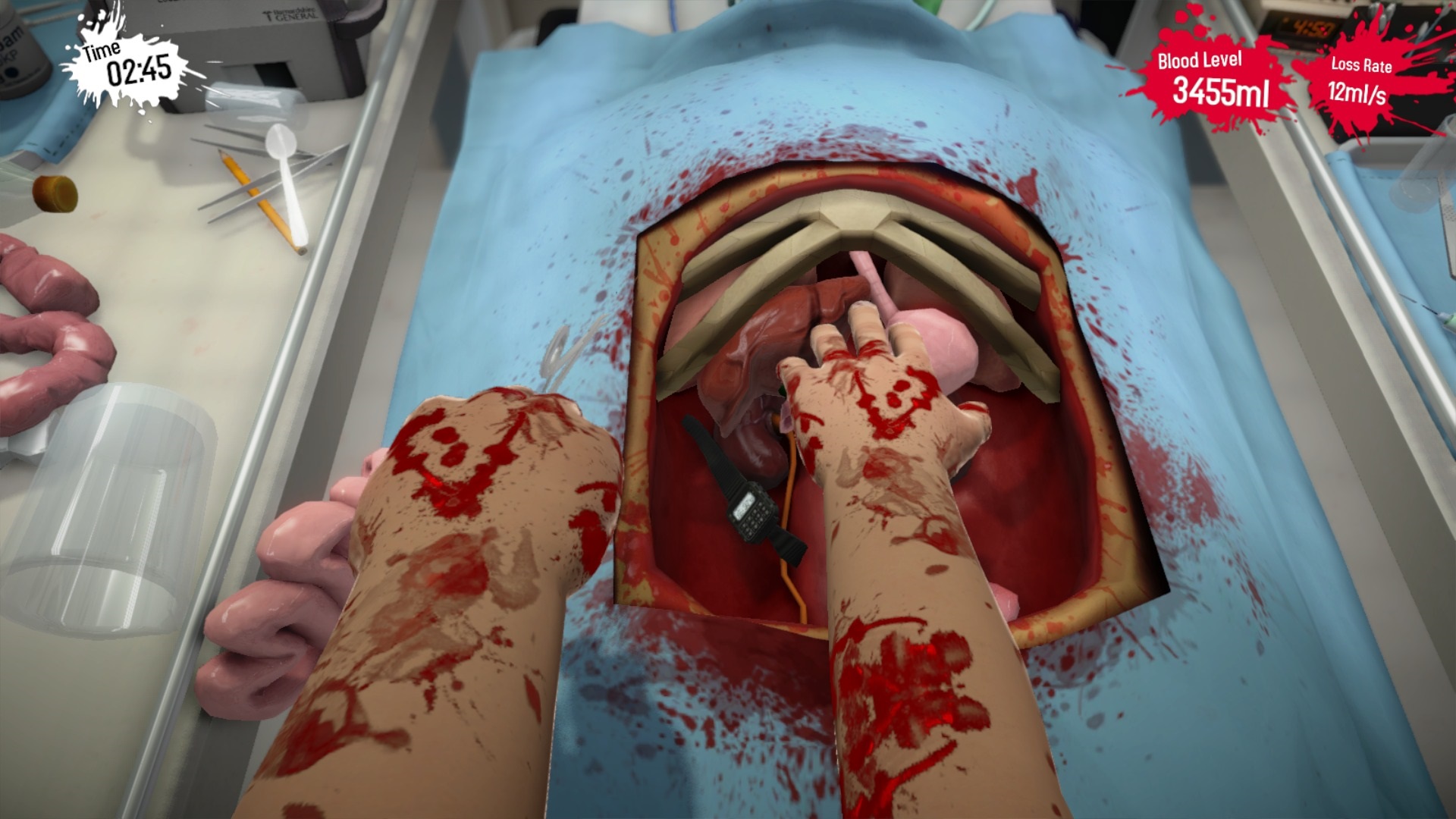 Surgeon Simulator: Anniversary Edition  Ak vs niekedy po opercii niekde pobolievalo, v hre sa dozviete dvod.