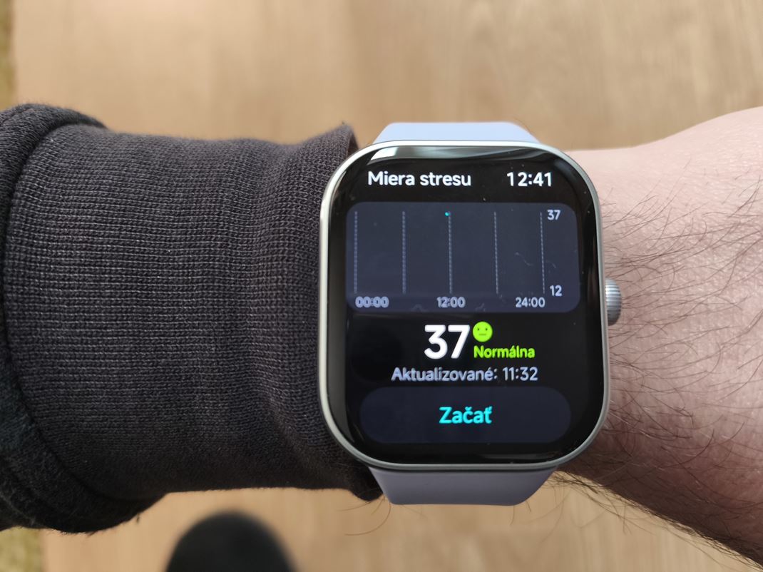 Redmi Watch 5 