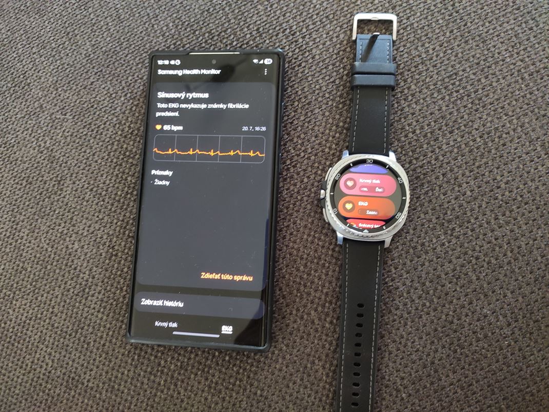 Samsung Watch 8 Classic Nechbaj zdravotn funkcie.